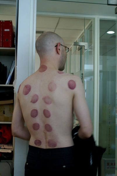 massage-chinois.JPG