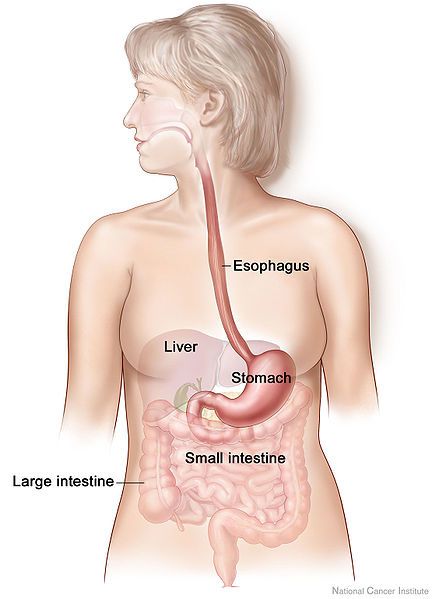reflux gastrique étouffement reflux gastrique étouffement