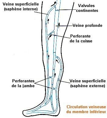 Le moyen des oedèmes à la varicosité
