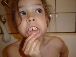 flavie-a-perdu-sa-1er-dent.jpg