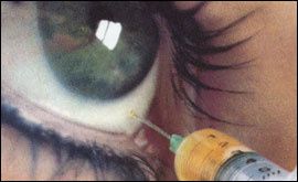 eye_main.jpg