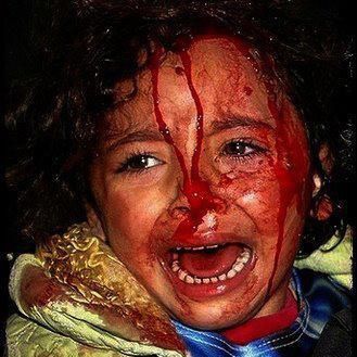 enfant-palestinien-blesse