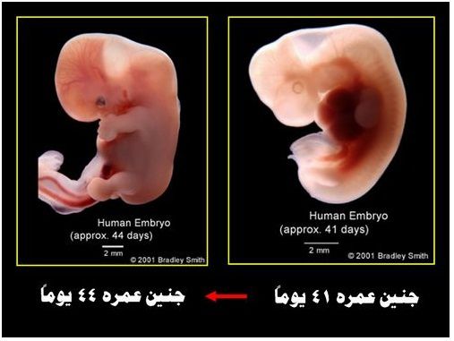 Embryon âgé de 41 et 44 jours