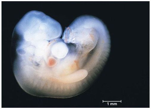Embryon âgé de 5 semaines
