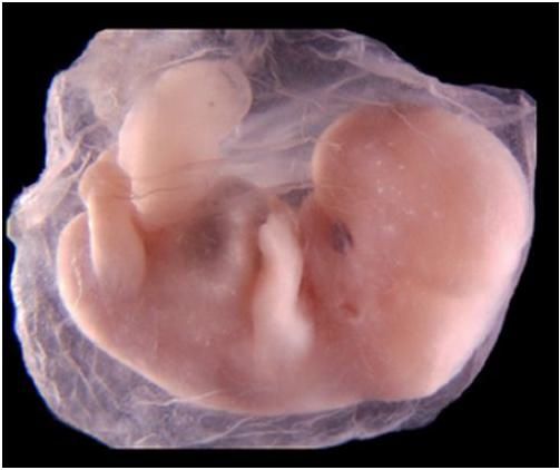 Image réel d'un embryon humain 47jrs