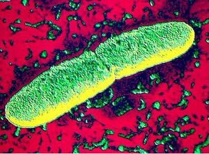 yersinia-pestis.jpg