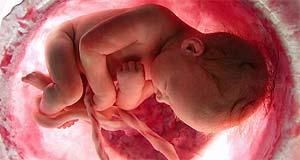 BÉBÉS Victimes de Contamination