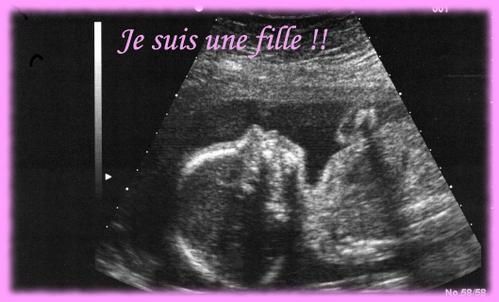 --cho-je-suis-une-fille2.jpg