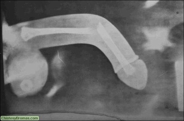 Radiographie de la fellation ... - Soumission Sociale