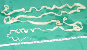 Que se nourrissent les parasites dans lintestin