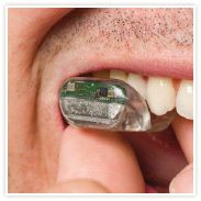 sound bite appareil auditif qui se clipse sur les dents nou
