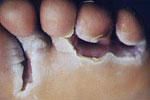 mes pieds me grattent mes pieds me grattent
