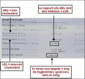 comprendre analyse de sang comprendre analyse de sang