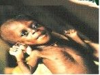 faim - enfant d'afrique
