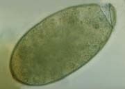 Fasciolopsis-buski-3.jpg
