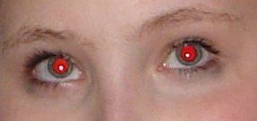 red-eye effect