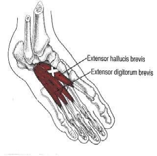 muscle du pied douleur muscle du pied douleur