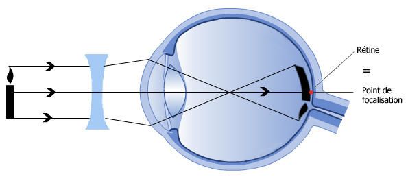 Les sacs sous les yeux le vomissement