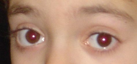 yeux rouges