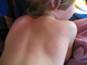allergie-004.jpg