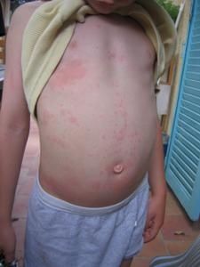 allergie-014.jpg