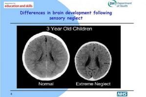 h-4-ill-910713-cerveau-bebe.jpg