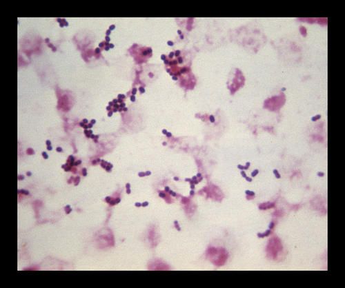 Enterococcus-faecalis.1.jpeg