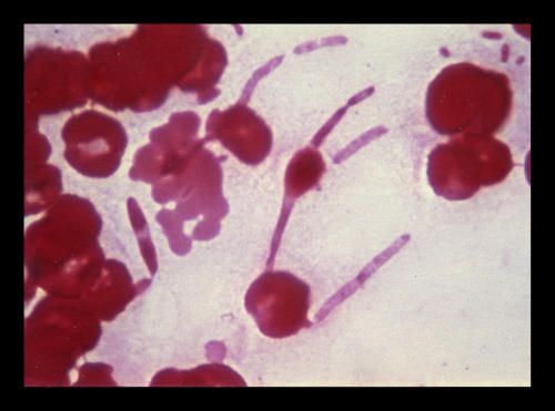 escherichia-coli.alt--r--s.jpg