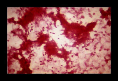escherichia-coli.jpg