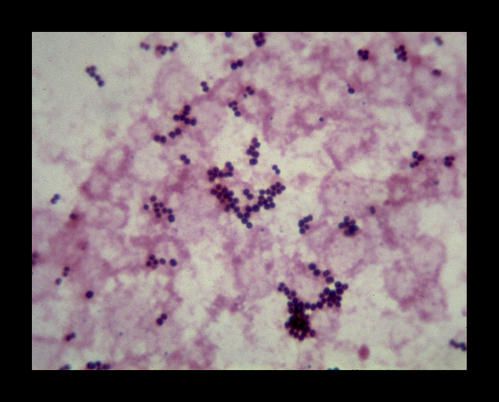 staphylococcus-aureus-copie-1.jpeg