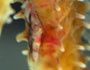 maladie--flesh-eating-bacteriafeb5.jpg