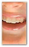 le langage des dents ou decodage dentaire du sourire