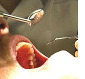 Sida chez le dentiste