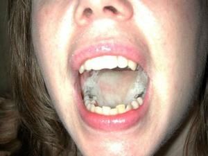 Dacryphilie Dacryphilie