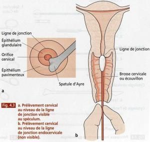 Fait mal fortement la tête et le cou la température 38