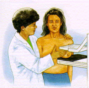Mammographie cancer du sein Mammographie