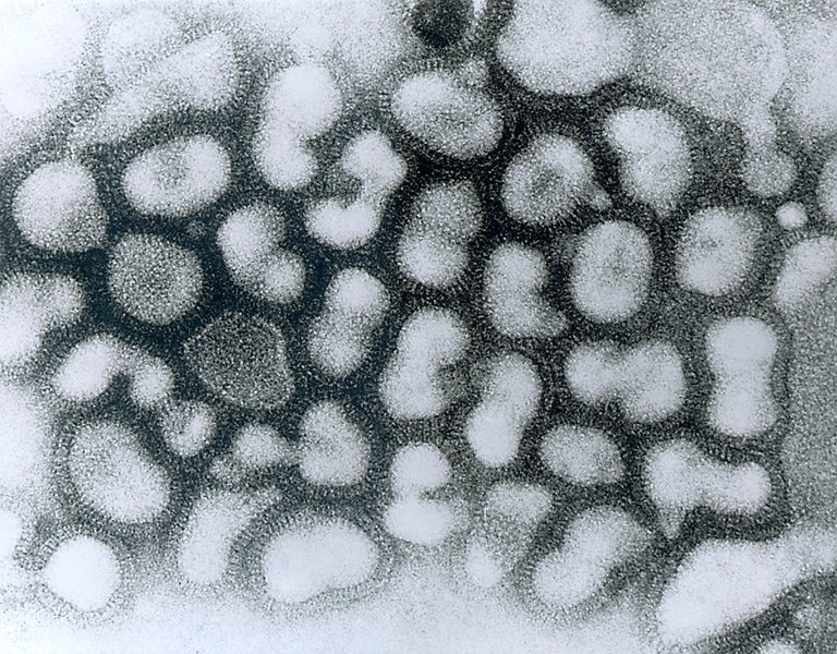 Virus influenza A en microscopie électronique à balayage: 1981 Source Wikipédia / USA Fédéral CDC/ Dr. Erskine Palmer