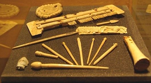 Les maladies des articulations des membres inférieurs des pieds