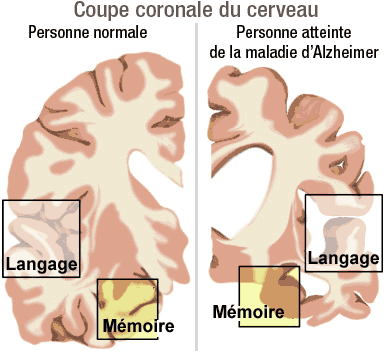 Sur la peau du membre sexuel la souillure
