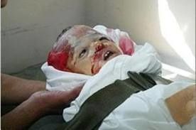 Palestine-enfant-irradie.jpg