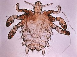 250px-Pthius pubis - crab louse