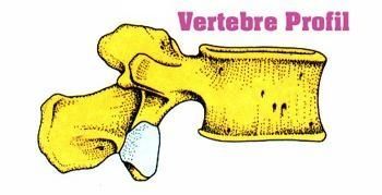 hernie2