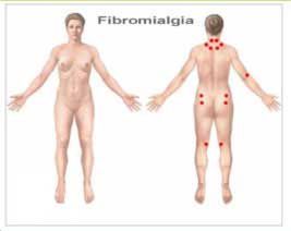 fibromialgia.jpg