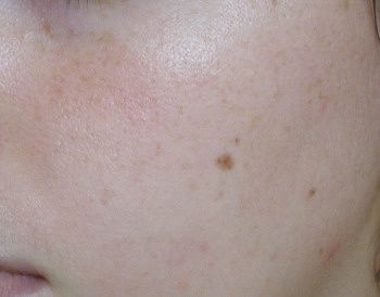 shiseido-peau-apres-1-mois_zoom.jpg