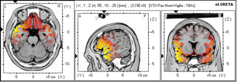 variacion-ritmo-cerebral1.png