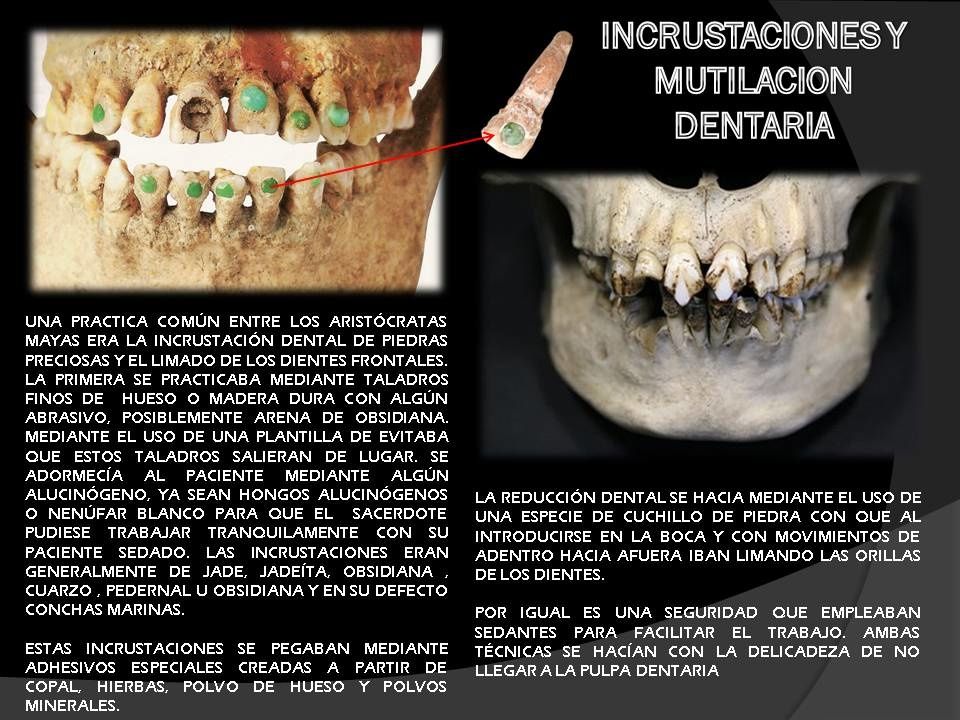 dientes-mayas1.jpg