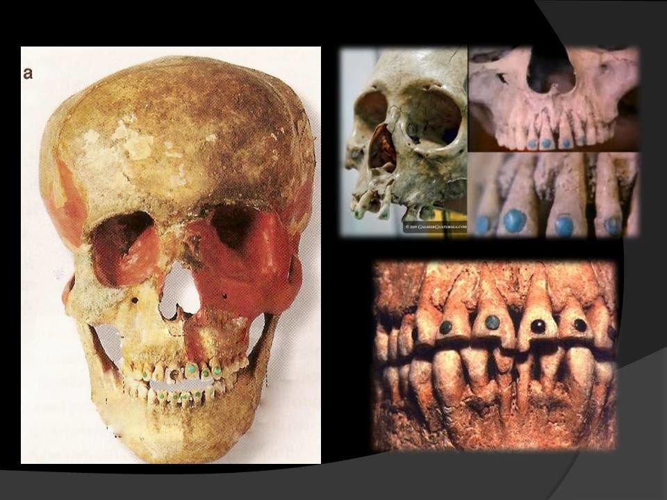 dientes-mayas2.jpg