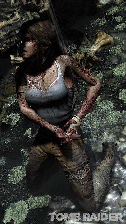 Lara-Injured-Fullsize.jpg