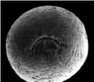 Gastrulation