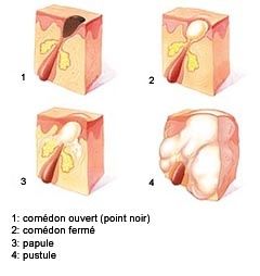 Comme soigner la peau de la personne avec les anguilles
